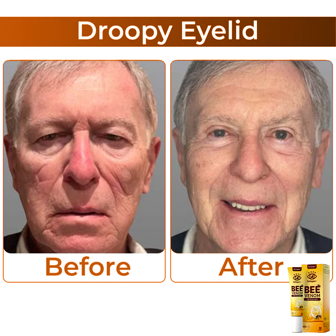 Méhméreg+Kollagén: Ébreszd fel a tekinteted