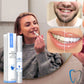 Branqueamento dental rápido para um sorriso radiante 