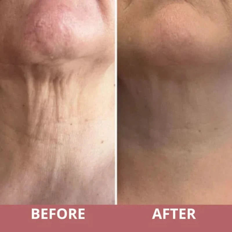 Straffende Creme für den Hals mit integriertem Massager 